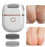 Electronic Pedicure Tool for Smooth Feet