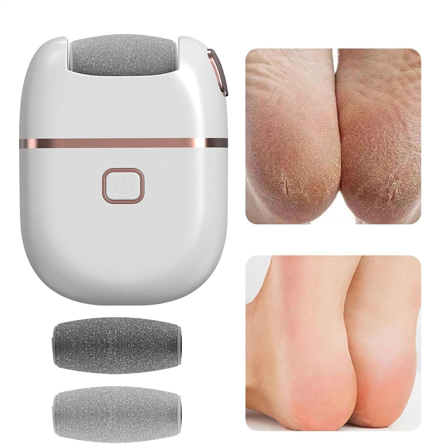 Electronic Pedicure Tool for Smooth Feet