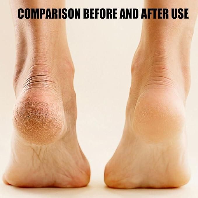 Electronic Pedicure Tool for Smooth Feet